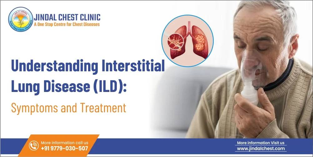 Understanding Interstitial Lung Disease (ILD): Symptoms and Treatment