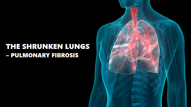 THE SHRUNKEN LUNGS – PULMONARY FIBROSIS